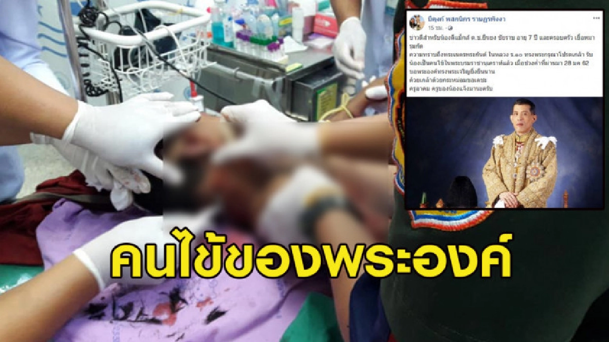 ในหลวง ร.10 ทรงรับ ด.ช. เหยื่อสุนัขรุมกัดเป็นคนไข้ของพระองค์ ในหลวง ร.10 ทรงรับ ด.ช. เหยื่อสุนัขรุมกัดเป็นคนไข้ของพระองค์