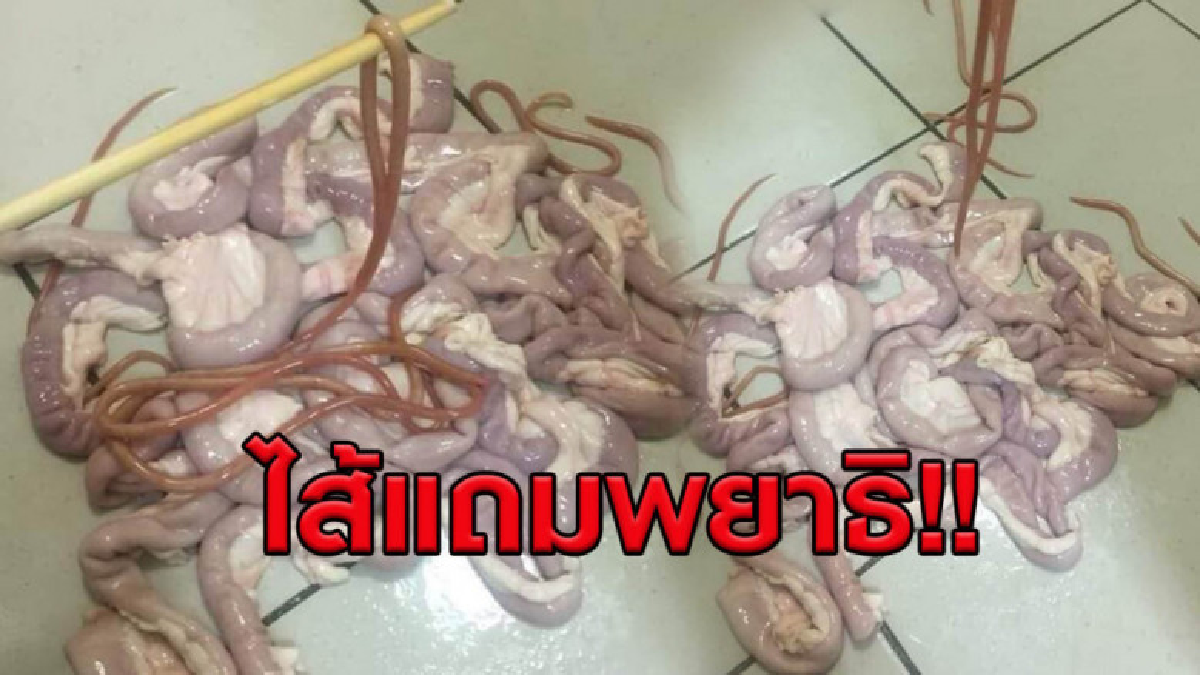 สาวผงะ ซื้อไส้หมูหวังทำไส้ย่าง แต่ได้พยาธิแถมมาทั้งยวง สาวผงะ ซื้อไส้หมูหวังทำไส้ย่าง แต่ได้พยาธิแถมมาทั้งยวง