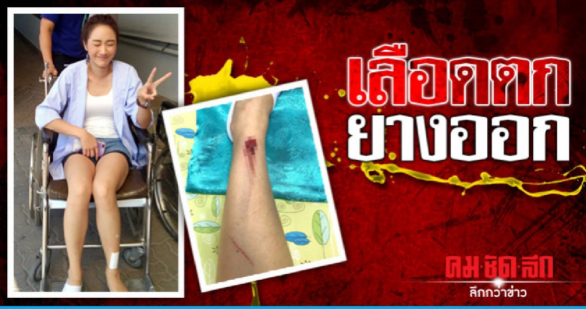 'ยีน' เกิดอุบัติเหตุกลางกอง