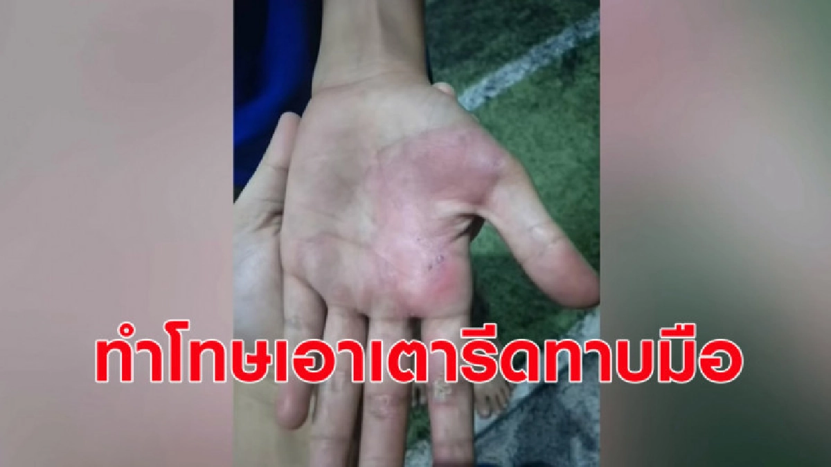 ลูกเลี้ยงวัย 13 กลับบ้านดึก ถูกพ่อเลี้ยงทำโทษเอาเตารีดทาบมือ ลูกเลี้ยงวัย 13 กลับบ้านดึก ถูกพ่อเลี้ยงทำโทษเอาเตารีดทาบมือ