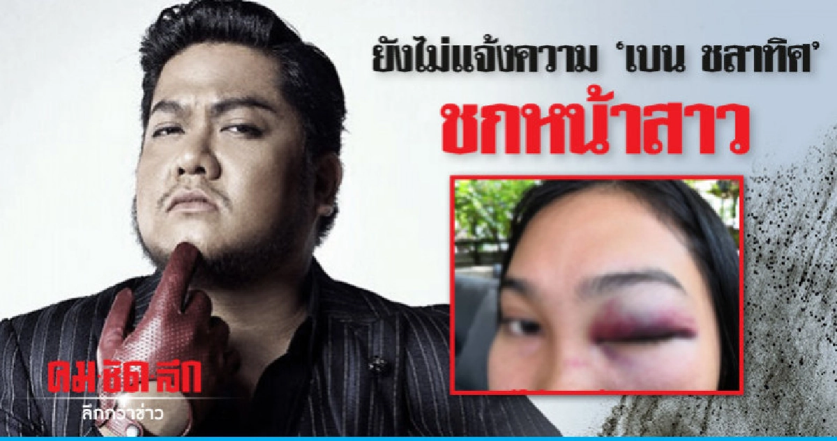 เหยื่อสาวถูกชกขอให้นักร้องดังมาขอโทษ