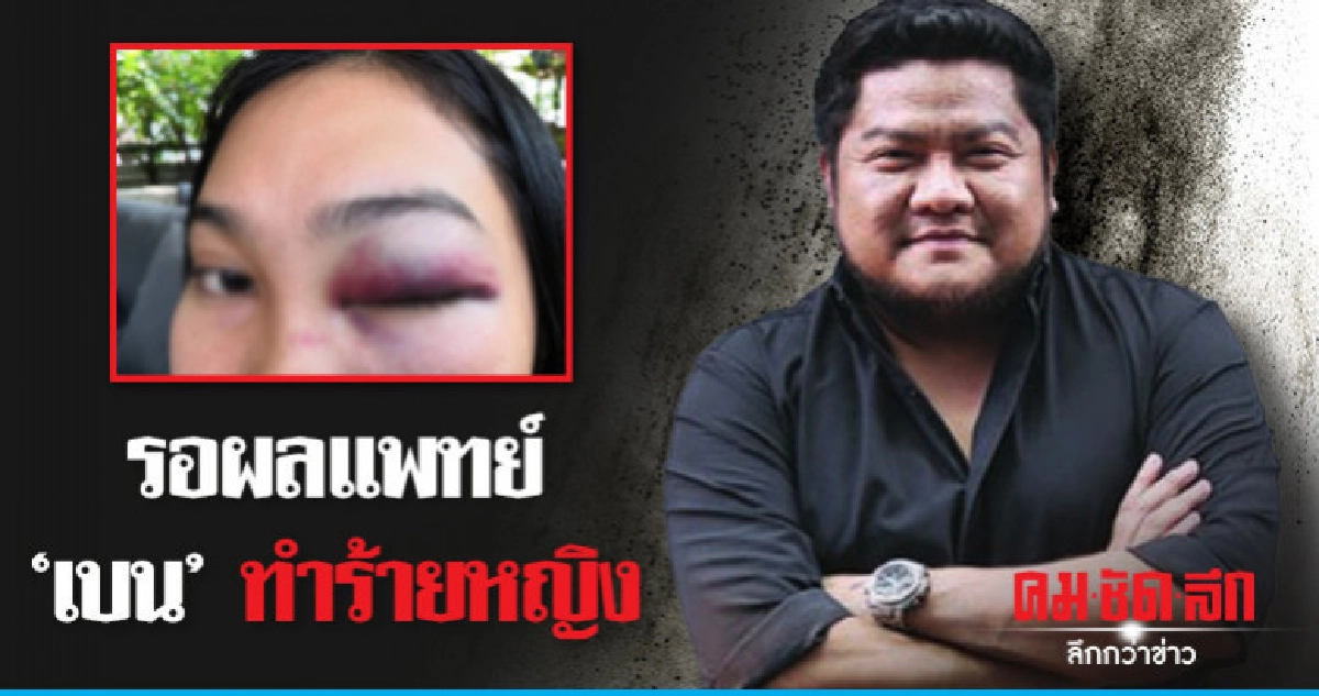 ตำรวจรอผลแพทย์"เบน"ทำร้ายหญิง ตำรวจรอผลแพทย์"เบน"ทำร้ายหญิง