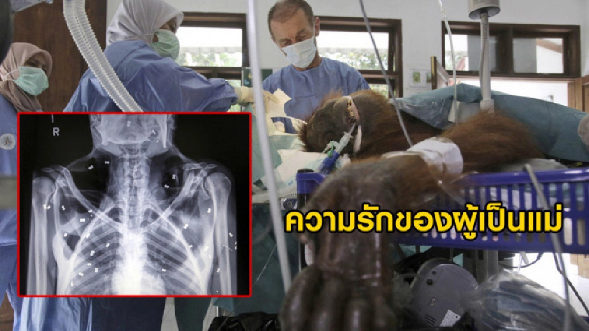 แม่อุรังอุตังปกป้องลูกถูกนักล่ายิง 74 นัดตาบอด