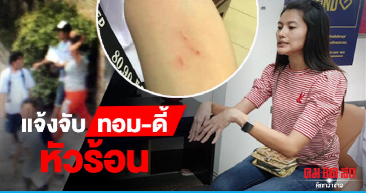 แม่แจ้งจับ "ทอม-ดี้" ทำร้ายลูกบาดเจ็บ