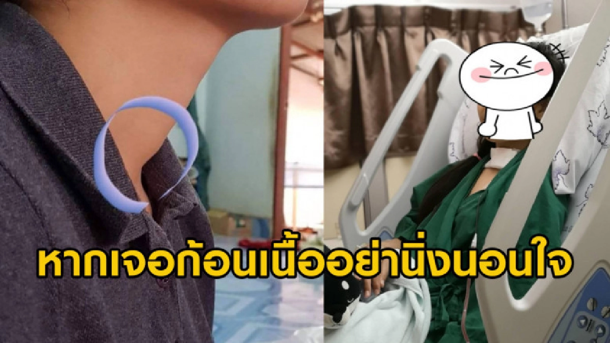 สาวคลำคอเจอก้อนเนื้อขนาดเล็กรีบผ่าออก พอตรวจพบเชื้อมะเร็ง สาวคลำคอเจอก้อนเนื้อขนาดเล็กรีบผ่าออก พอตรวจพบเชื้อมะเร็ง