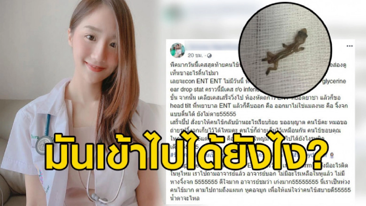 คุณหมอถึงกับตะลึงทำงานวันแรก เจอเคสสุดแปลก คุณหมอถึงกับตะลึงทำงานวันแรก เจอเคสสุดแปลก