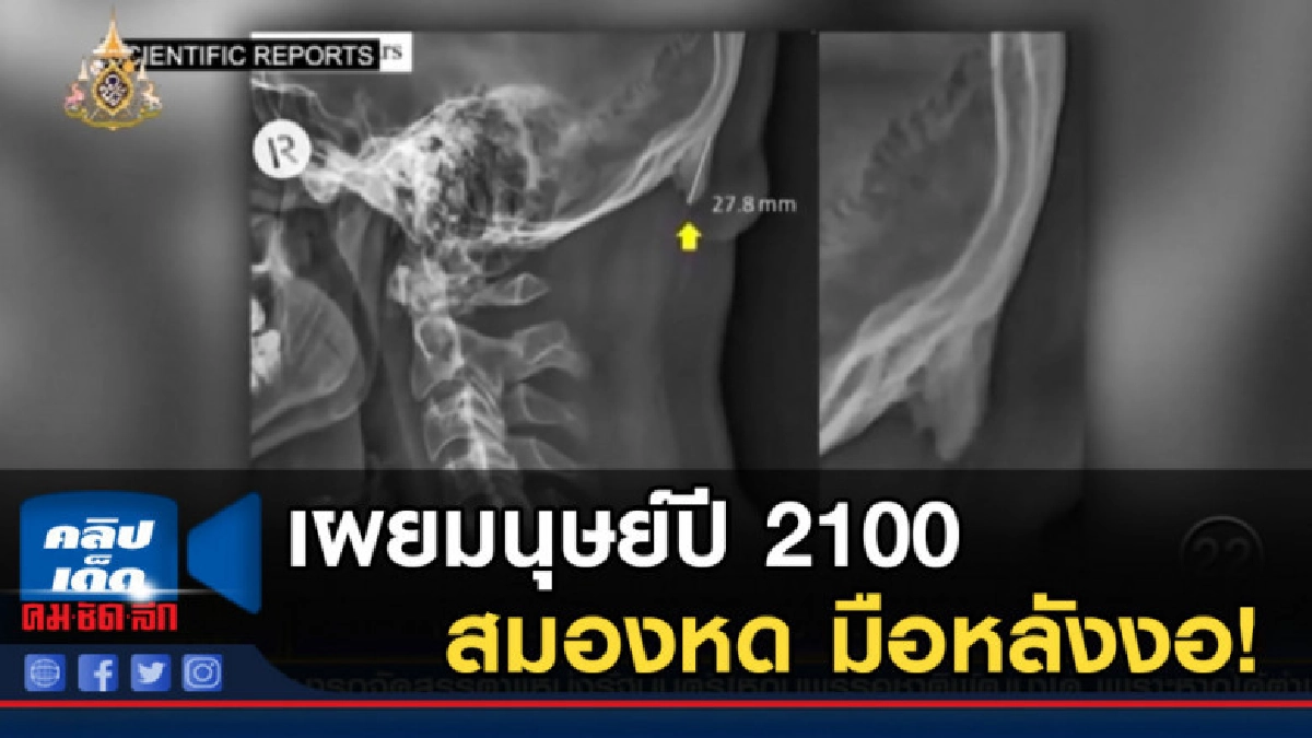 เผยมนุษย์ปี 2100 แปรสภาพ ใช้สมาร์ทโฟนมาก สมองหด มือหลังงอ! เผยมนุษย์ปี 2100 แปรสภาพ ใช้สมาร์ทโฟนมาก สมองหด มือหลังงอ!