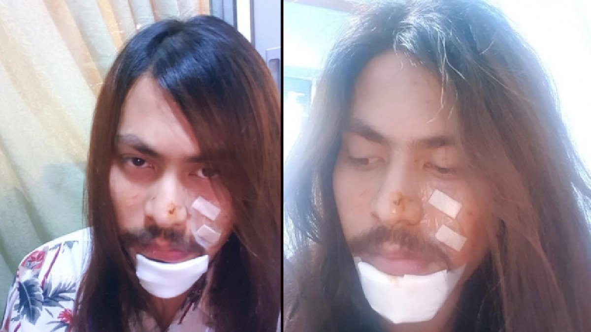 หนุ่มนักร้องนำวงร็อค ถูกทำร้ายร่างกาย หนุ่มนักร้องนำวงร็อค ถูกทำร้ายร่างกาย