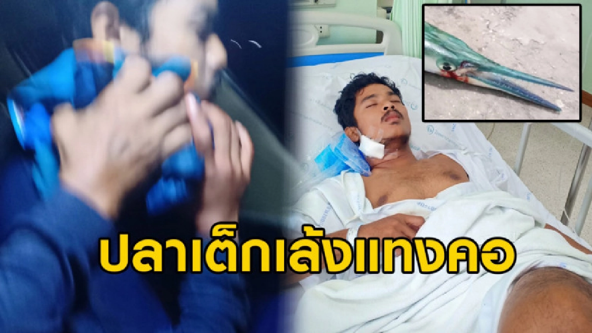 หนุ่มออกหาปลาถูกปลาเต็กเล้งกระโดดทิ่มคอ หนุ่มออกหาปลาถูกปลาเต็กเล้งกระโดดทิ่มคอ