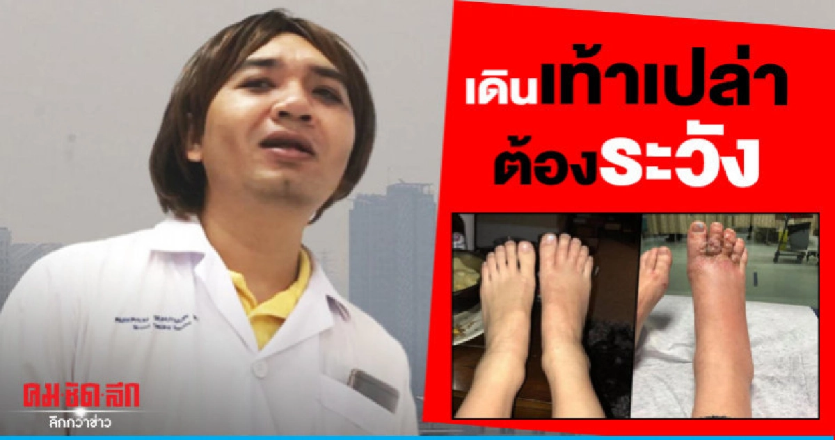 เตือน เดินชายหาดเท้าเปล่า เสี่ยงพยาธิไชเท้า