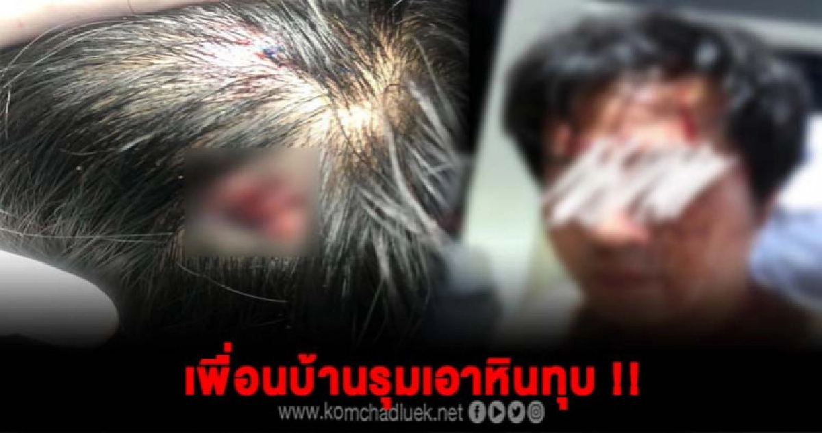 หนุ่มนักร้องโวย เจอเพื่อนบ้านสุดโหด ใช้ก้อนหินทุบหัวทุบหน้า