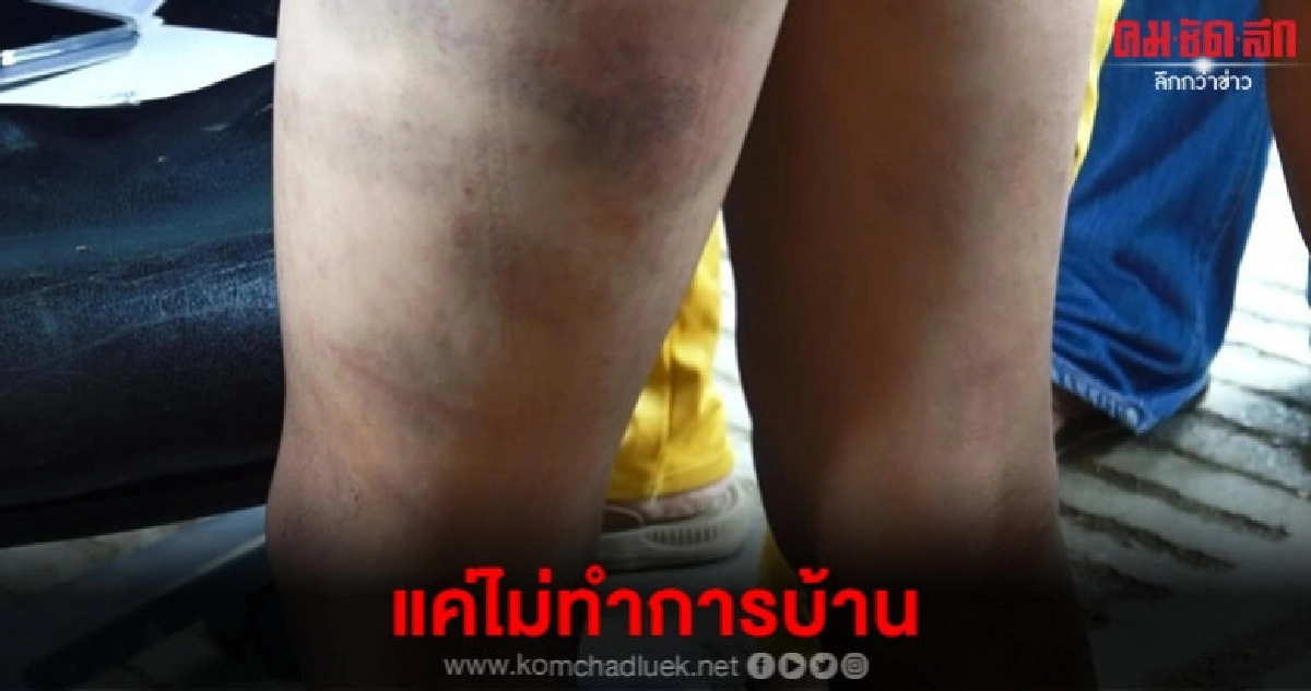 ครูโหดลงโทษเด็ก 9 ขวบน่วม แค่ไม่ทำการบ้าน ครูโหดลงโทษเด็ก 9 ขวบน่วม แค่ไม่ทำการบ้าน
