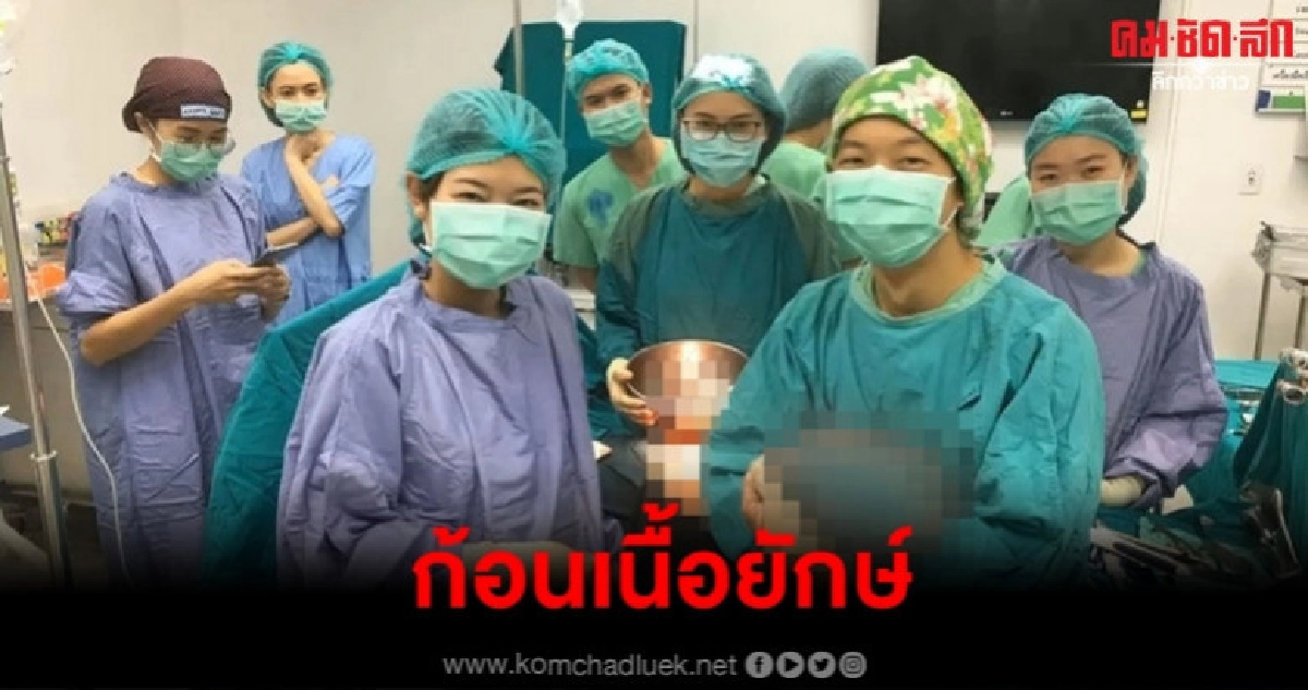 หมอตะลึง ผ่าตัดเจอก้อนเนื้อยักษ์ในช่องท้องหนัก 5.4 กก.