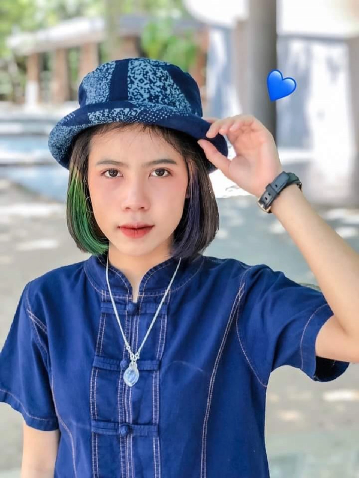 ด่วน นักร้องสาวกระต่าย พรรณนิภา ประสบอุบัติเหตุ 