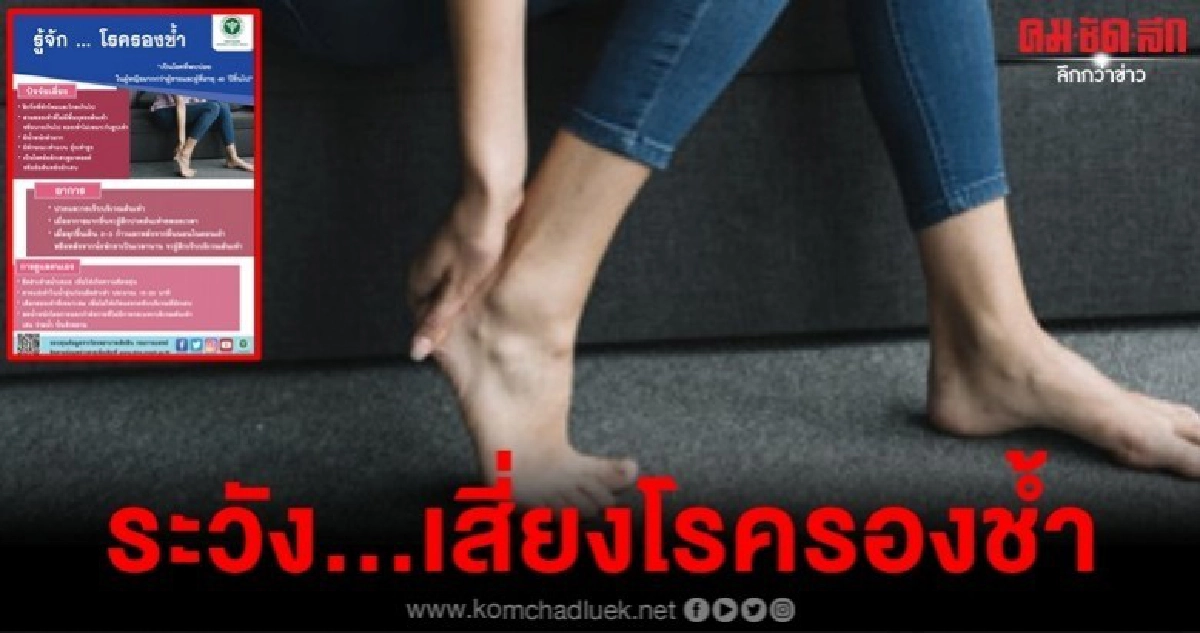 ระวัง...เสี่ยงโรครองช้ำ ระวัง...เสี่ยงโรครองช้ำ