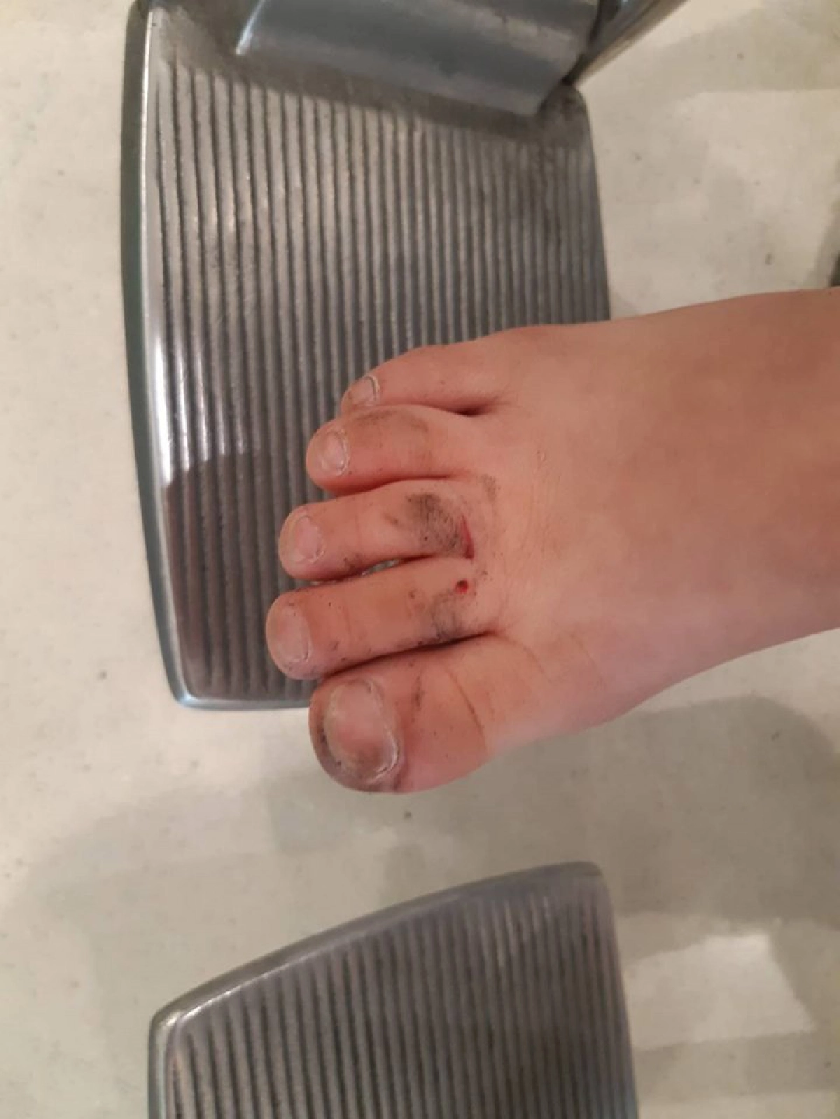 เตือนภัยลูกน้อยถูกบันไดเลื่อนดูดรองเท้าเข้าไป โชคดีดึงออกทัน
