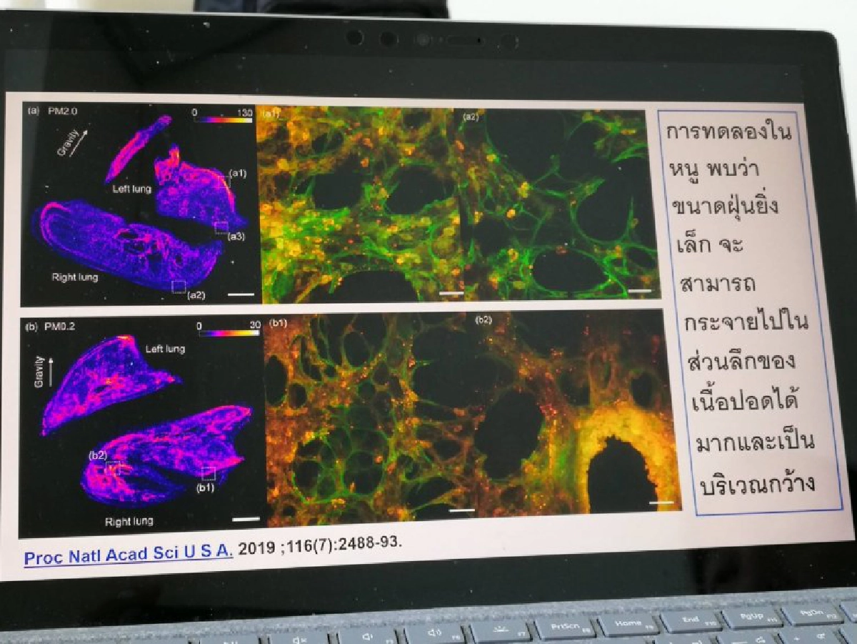 แพทย์เตือนพีเอ็ม2.5ส่งผลตับไตทำงานผิดปกติถึงขั้นเสียชีวิต