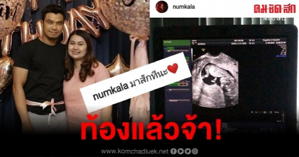 เบบี๋มาแล้ว หนุ่ม กะลา สุดแฮปปี้ เตรียมตัวเป็นคุณพ่อ เบบี๋มาแล้ว หนุ่ม กะลา สุดแฮปปี้ เตรียมตัวเป็นคุณพ่อ