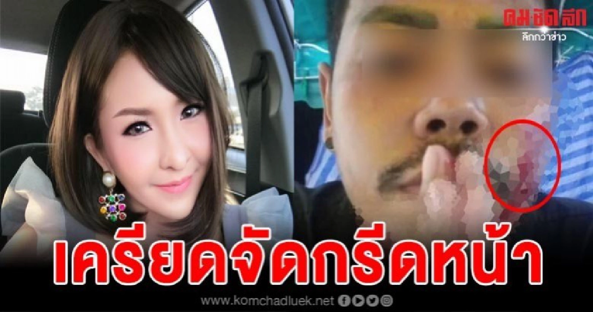 ลูกทีมมะนาวไลฟ์สดกรีดหน้าตัวเอง เครียดจัดไม่ได้เงินคืน ลูกทีมมะนาวไลฟ์สดกรีดหน้าตัวเอง เครียดจัดไม่ได้เงินคืน