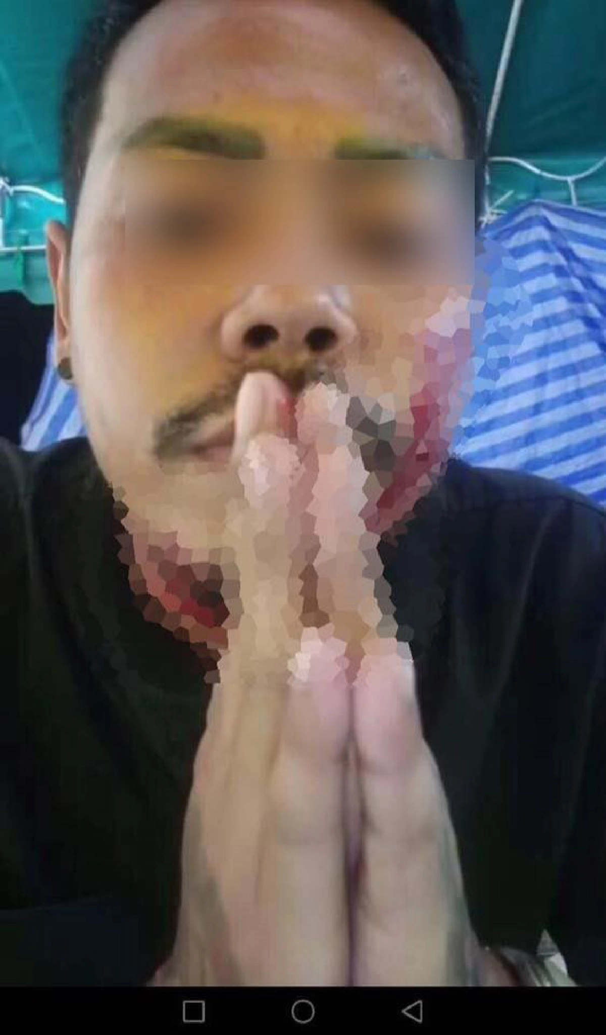 ลูกทีมมะนาวไลฟ์สดกรีดหน้าตัวเอง เครียดจัดไม่ได้เงินคืน 