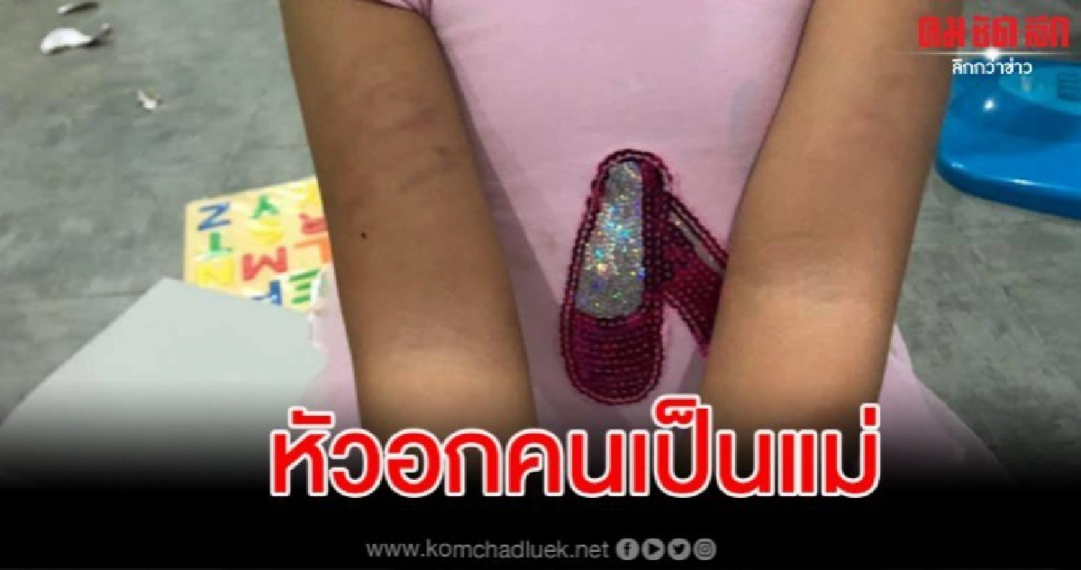 แม่ใจสลาย ส่งลูกไปเรียนหวังจะได้เรียนรู้ แต่ได้รอยฟกช้ำมาแทน