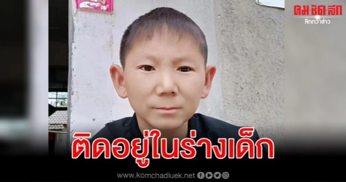 ชายจีนวัย 34 ยังเหมือนเด็กชายจากอุบัติเหตุในวัยเยาว์ 