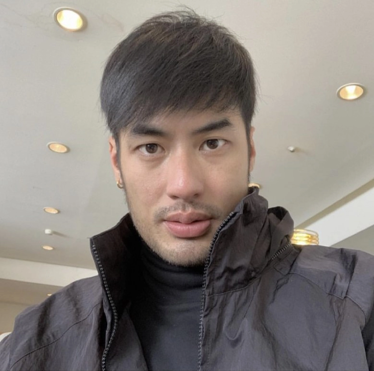 บอยเผยวินาทีรู้ตัวโดนแมลงกินเนื้อคนกัดคาดโดนตอนแช่ออนเซ็น