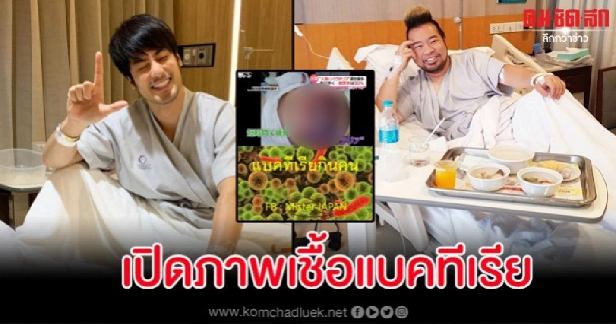 ภาพชวนยี้เชื้อแบคทีเรียกินคน ผู้ติดเชื้อในญี่ปุ่นเพิ่มทุกปี ภาพชวนยี้เชื้อแบคทีเรียกินคน ผู้ติดเชื้อในญี่ปุ่นเพิ่มทุกปี