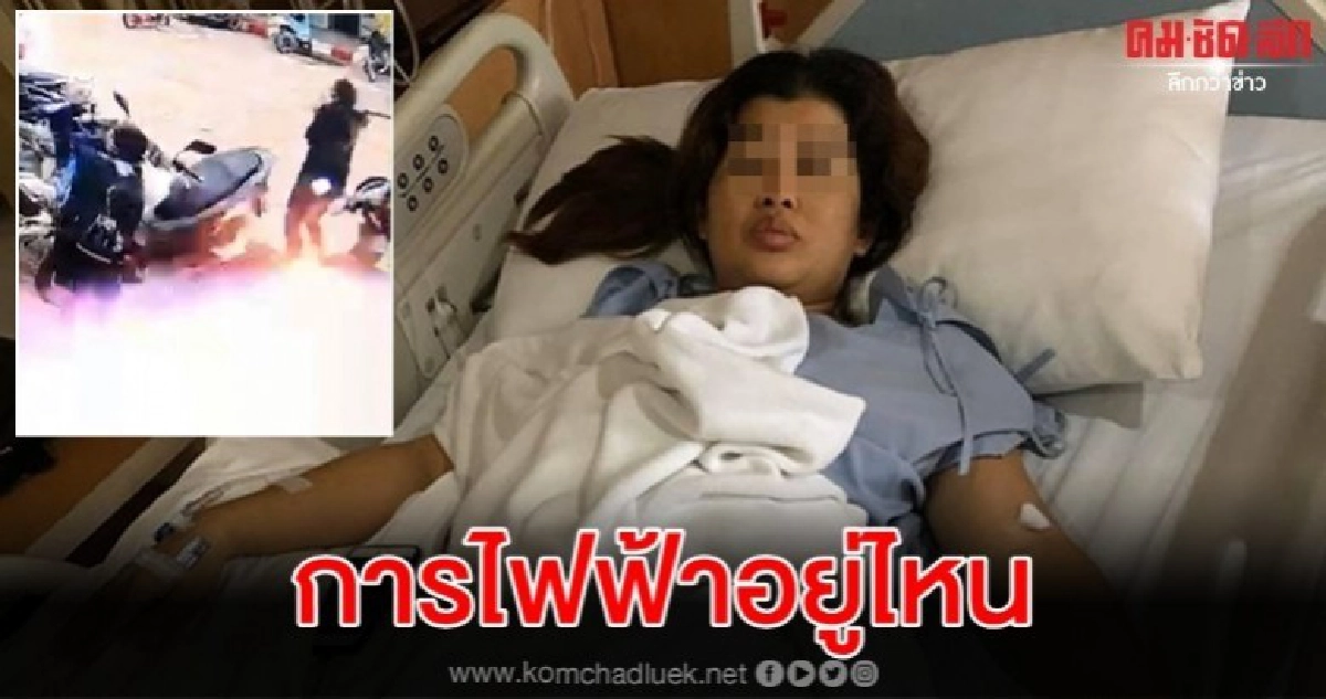 หนุ่มเดือดแฟนถูกสายไฟร่วงไหม้ขาไร้หน่วยงานเหลียวแล หนุ่มเดือดแฟนถูกสายไฟร่วงไหม้ขาไร้หน่วยงานเหลียวแล