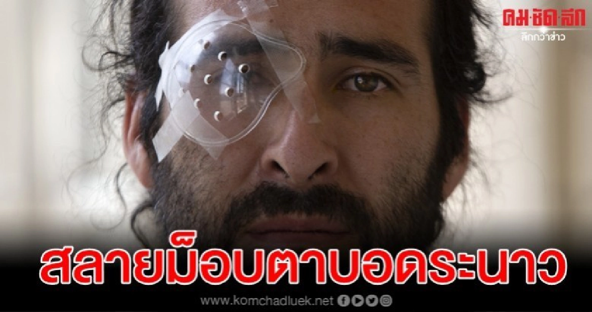 วิกฤติซ้อนวิกฤติ หนุ่มสาวชิลีตาบอดเป็นร้อย ตร.สลายม็อบ วิกฤติซ้อนวิกฤติ หนุ่มสาวชิลีตาบอดเป็นร้อย ตร.สลายม็อบ