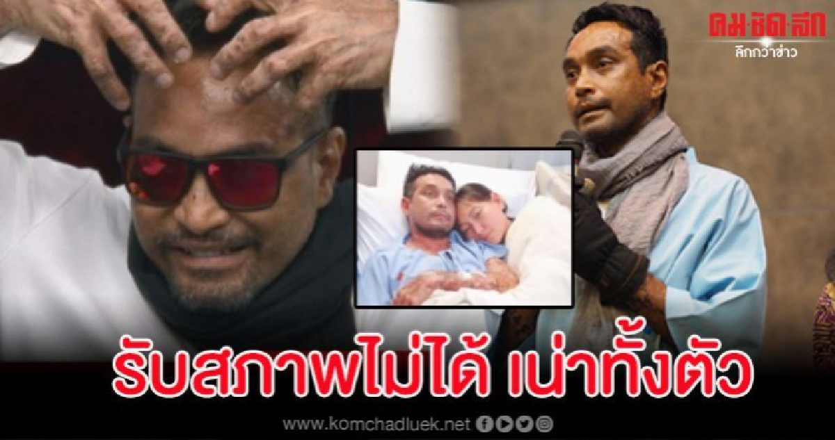 เปิดไทม์ไลน์ 'เมฆ วินัย' ป่วยโรคร้าย 5 เดือน สภาพเน่าทั้งตัว