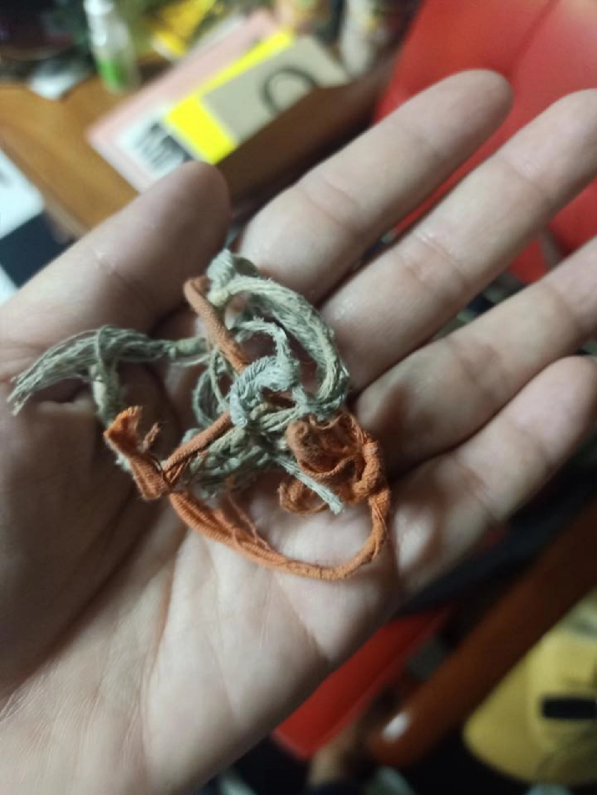 ลูกน้อยเอาหนังยางใส่ข้อมือ รู้ตัวอีกทียางรัดจนแผลเหวอะ