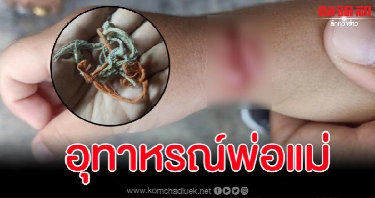 ลูกน้อยเอาหนังยางใส่ข้อมือ รู้ตัวอีกทียางรัดจนแผลเหวอะ
