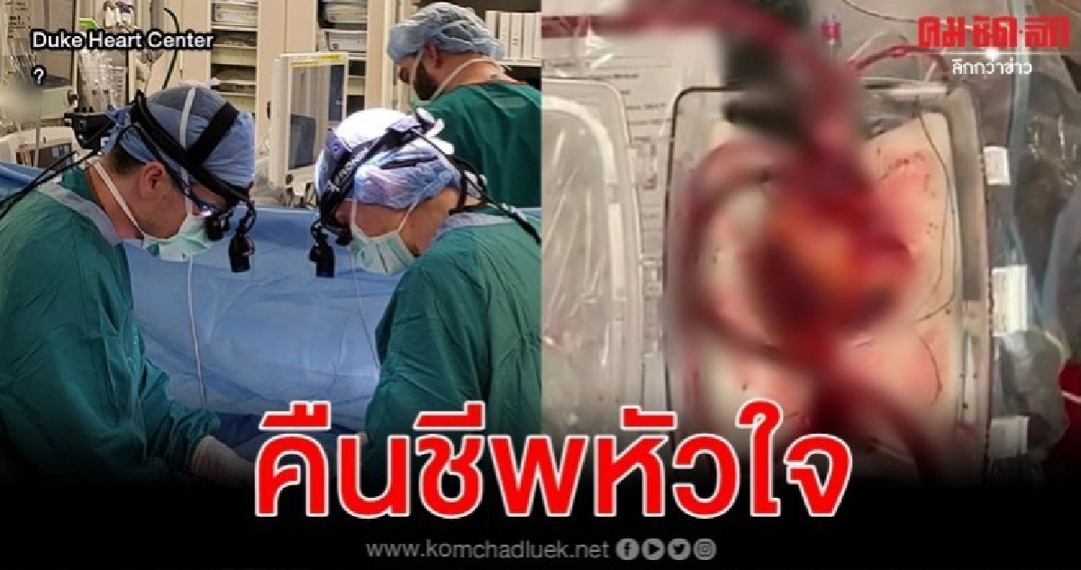 หมอสหรัฐปลูกถ่ายหัวใจจากคนตายรายแรกโพสต์คลิปหัวใจเต้นสุดทึ่ง หมอสหรัฐปลูกถ่ายหัวใจจากคนตายรายแรกโพสต์คลิปหัวใจเต้นสุดทึ่ง