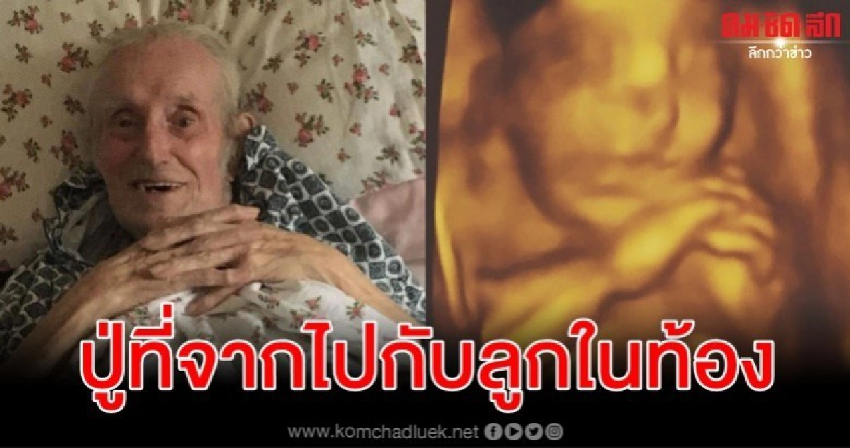  แม่น้ำตาไหลเห็นภาพสแกน 4 มิติลูกในท้องคล้ายคุณปู่ที่จากไป 