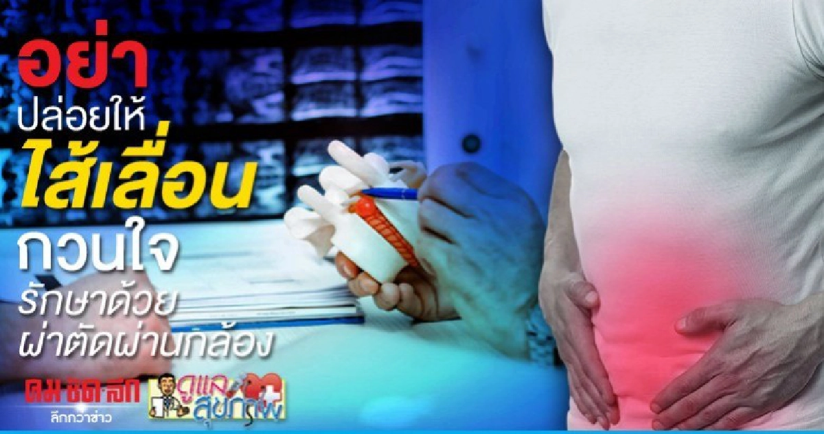 อย่าปล่อยให้ไส้เลื่อนกวนใจ รักษาด้วยผ่าตัดผ่านกล้อง อย่าปล่อยให้ไส้เลื่อนกวนใจ รักษาด้วยผ่าตัดผ่านกล้อง