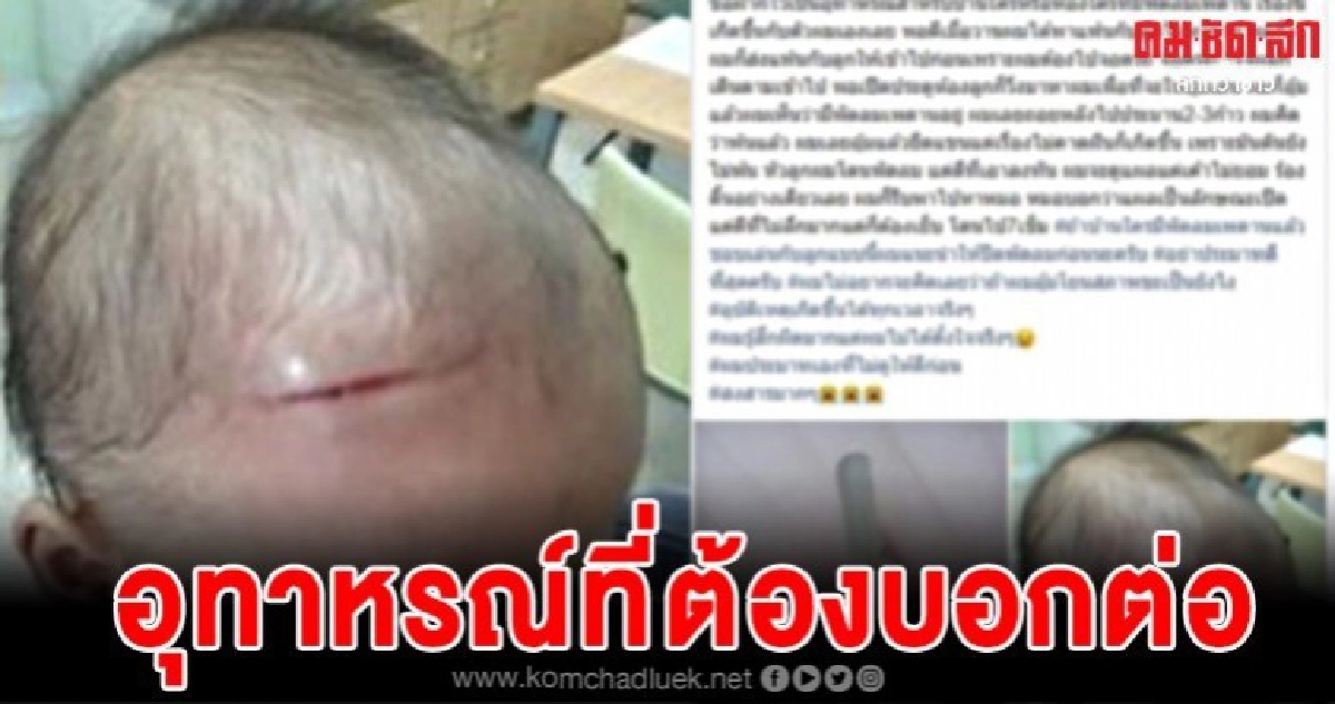 พ่อสุดเศร้า อุ้มลูกชูขึ้นเพดาน โดนเย็บไป 7 เข็ม 