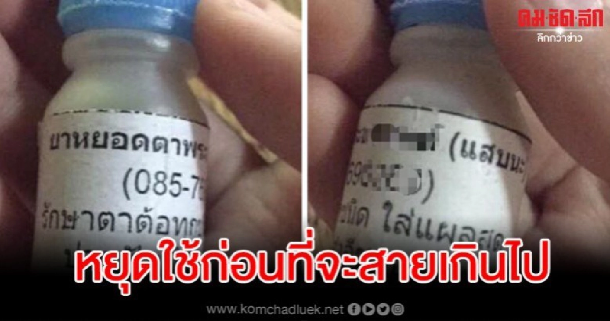 ยาหยอดตาเถื่อนสรรพคุณครอบจักรวาล บางเคสถึงขั้นควักลูกตาออก