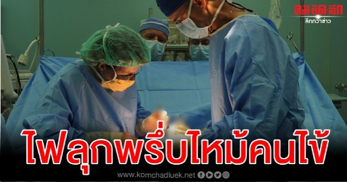 ผู้ป่วยมะเร็งดับ ทีมแพทย์จุดไฟเผาคนไข้ไม่ตั้งใจระหว่างผ่าตัด ผู้ป่วยมะเร็งดับ ทีมแพทย์จุดไฟเผาคนไข้ไม่ตั้งใจระหว่างผ่าตัด