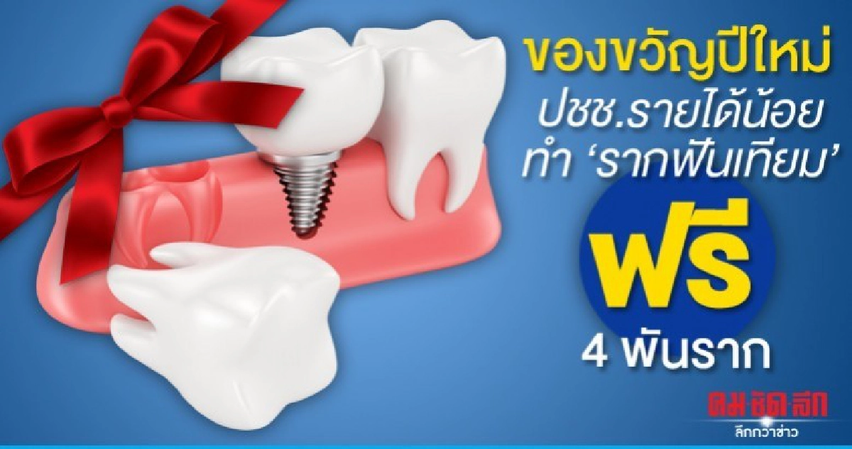 ครม.ไฟเขียวปชช.รายได้น้อยทำรากฟันเทียมฟรี 4 พันราก 