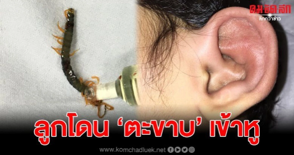 แม่สุดกังวลใจ ลูกโดน 'ตะขาบ' เข้าหู แถมโดนกัดจนบวม แม่สุดกังวลใจ ลูกโดน 'ตะขาบ' เข้าหู แถมโดนกัดจนบวม