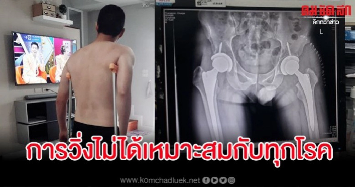 ทหารหนุ่มแชร์ประสบการณ์วิ่งสู้โรคตามเทรนด์สุดท้ายร่างพัง