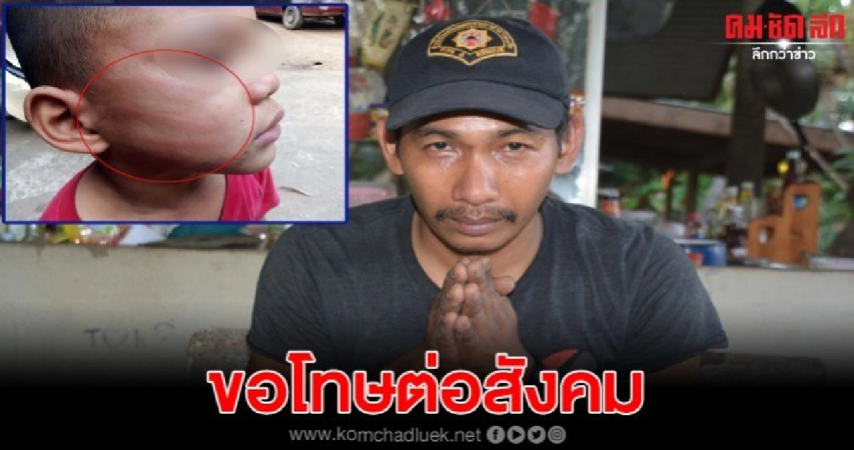 อบต. ตบเด็กชาย 6 ขวบ ออกมาขอโทษครอบครัวเด็กและสังคม อบต. ตบเด็กชาย 6 ขวบ ออกมาขอโทษครอบครัวเด็กและสังคม