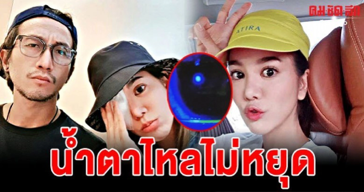  ตูน พาก้อยหาหมอด่วนหลังเกิดอุบัติเหตุกระจกตาถลอก