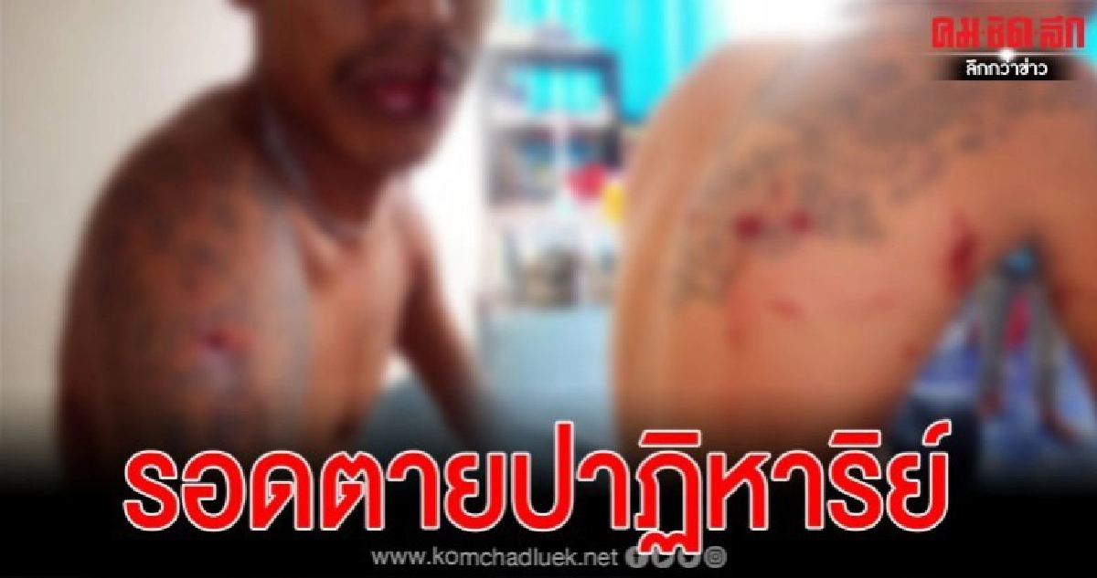 สุดระทึก หนุ่มตามหาสุนัขในป่า แต่กลับถูกเสือขย้ำ สุดระทึก หนุ่มตามหาสุนัขในป่า แต่กลับถูกเสือขย้ำ