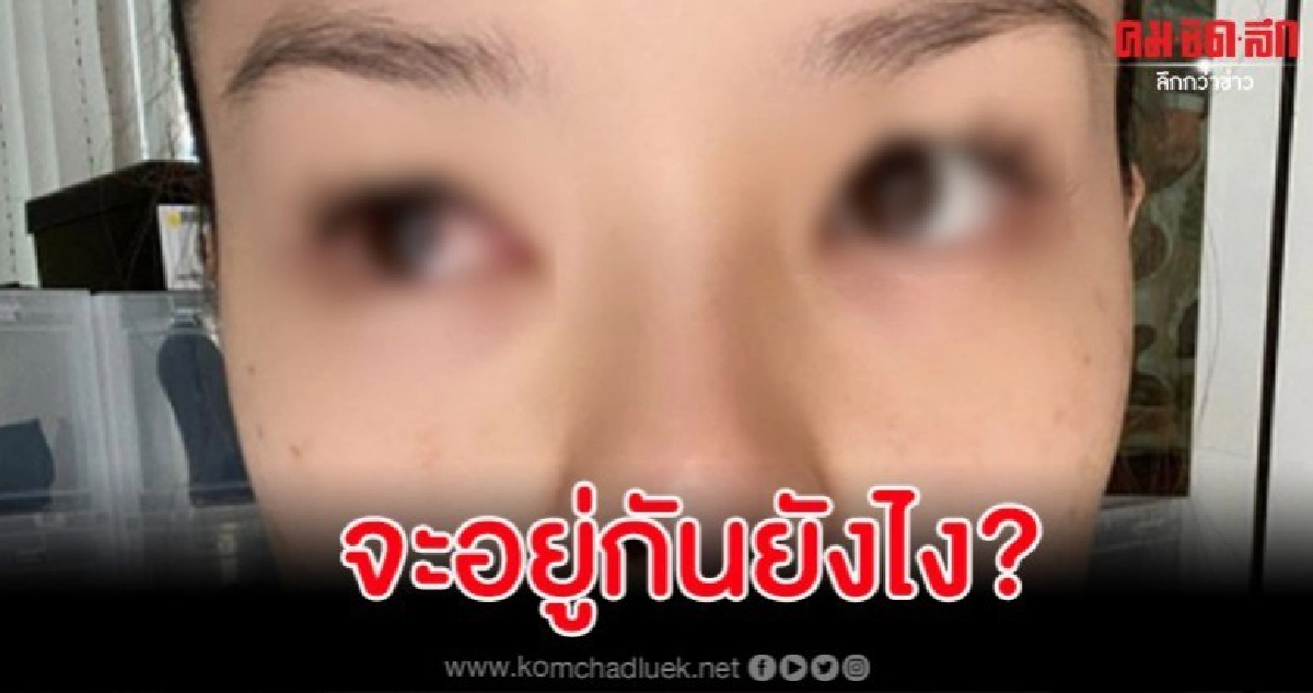 'ลิเดีย' ตาอักเสบเจอฝุ่น PM 2.5 เล่นงาน 