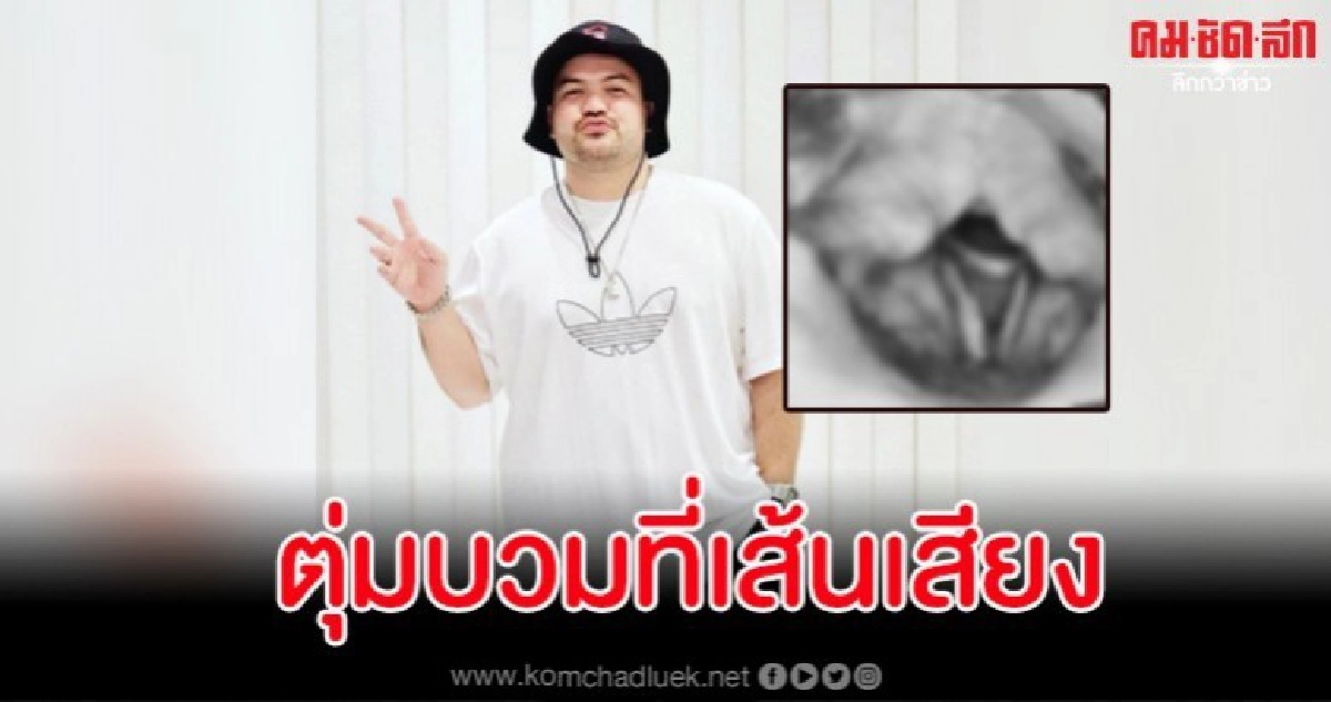 'โอ๊ต ปราโมทย์' แจ้งข่าวตุ่มบวมที่เส้นเสียงเตรียมผ่าตัดรักษา 'โอ๊ต ปราโมทย์' แจ้งข่าวตุ่มบวมที่เส้นเสียงเตรียมผ่าตัดรักษา