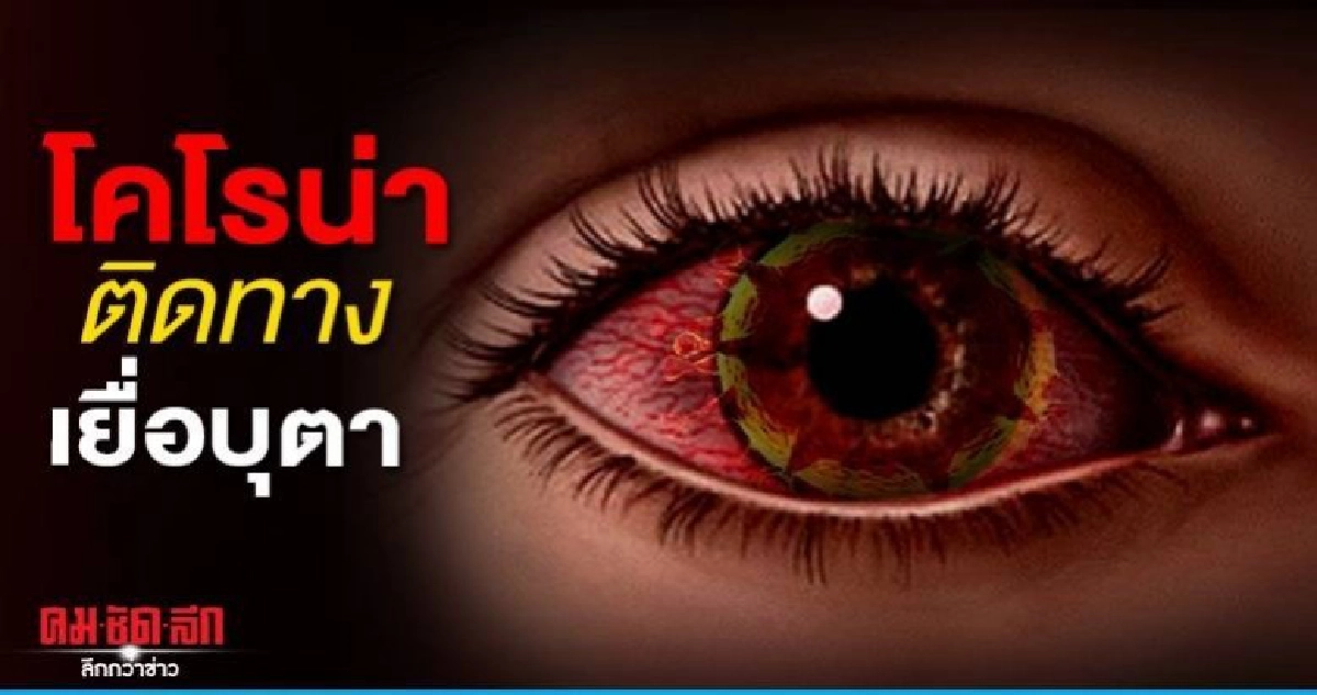 รู้ยัง..ไวรัสโคโรน่า ติดต่อทางเยื่อบุตา