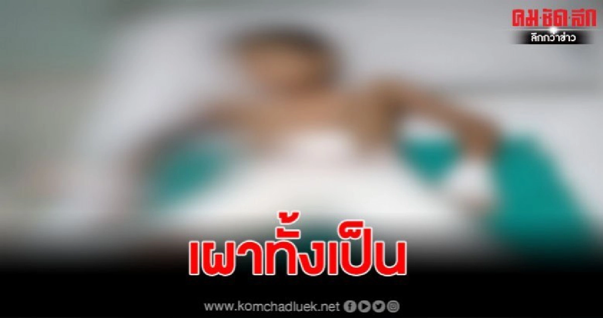 เด็ก ป.2 กดน้ำมันราดรุ่นพี่ ป.3 พร้อมจุดไฟเผาทั้งเป็น 