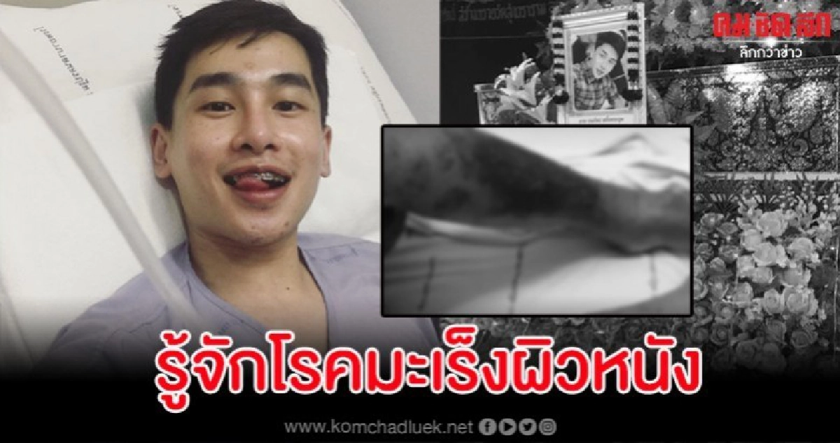 รู้จักโรคมะเร็งผิวหนังสาเหตุคร่าชีวิต 'กอล์ฟ ธนภัทร'